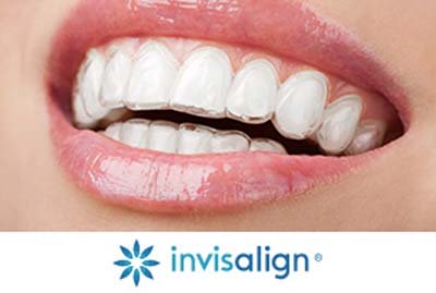 TRATTAMENTI INVISALIGN (ORTODONZIA INVISIBILE)